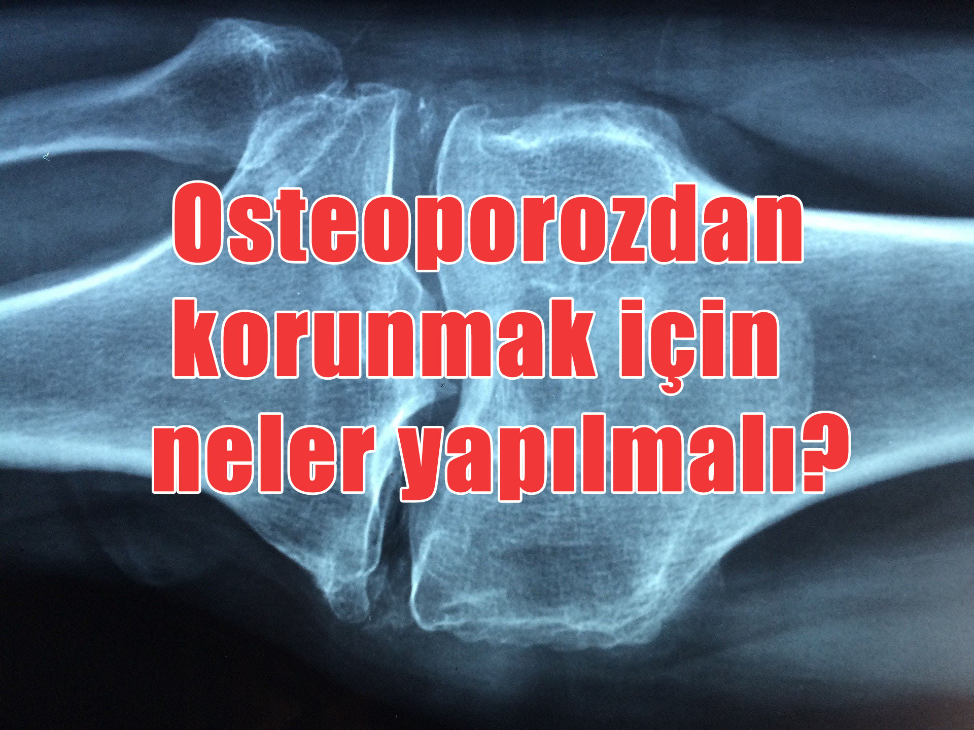 Osteoporozdan